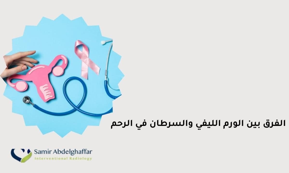 الفرق بين الورم الليفي والسرطان في الرحم