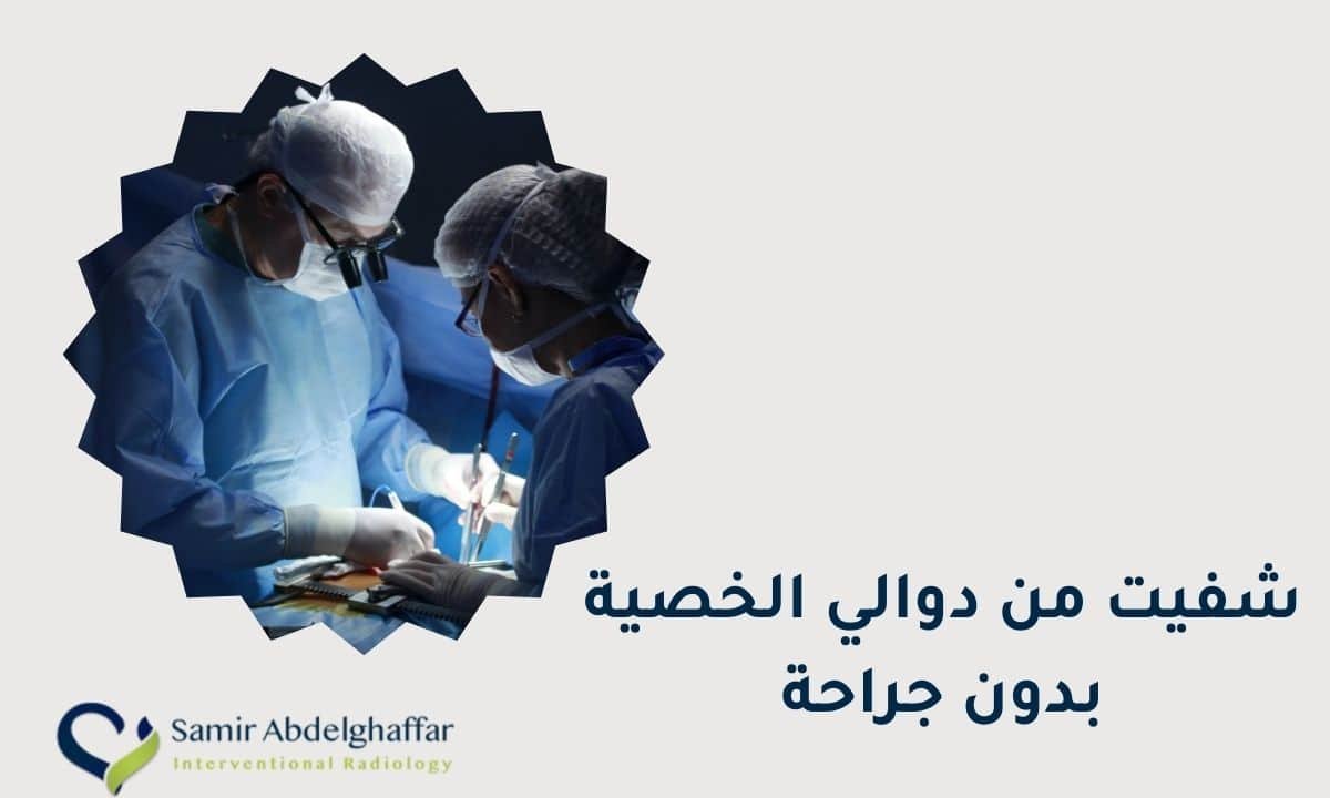 شفيت من دوالي الخصية بدون جراحة