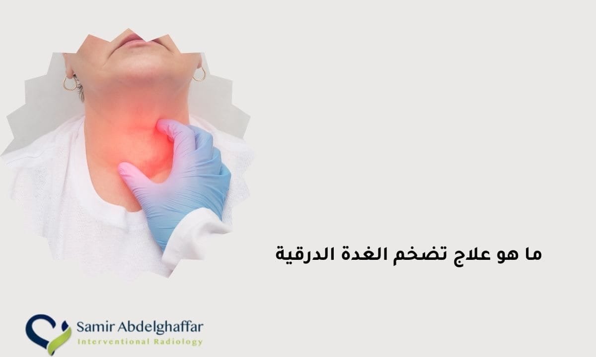 ما هو علاج تضخم الغدة الدرقية