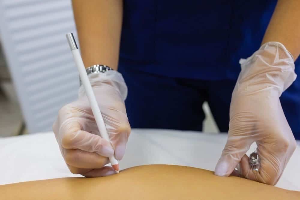 افضل مركز لعلاج دوالي الخصية بالقسطرة 