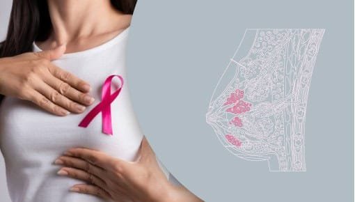 استئصال الرحم 