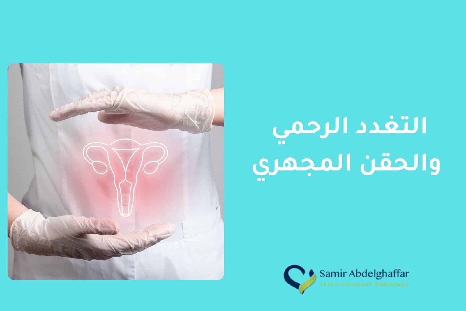 التغدد الرحمي والحقن المجهري