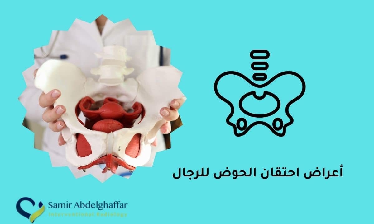 أعراض احتقان الحوض للرجال