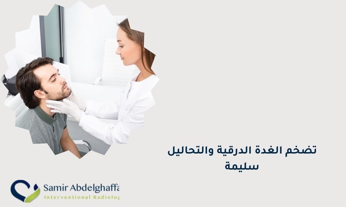 تضخم الغدة الدرقية والتحاليل سليمة