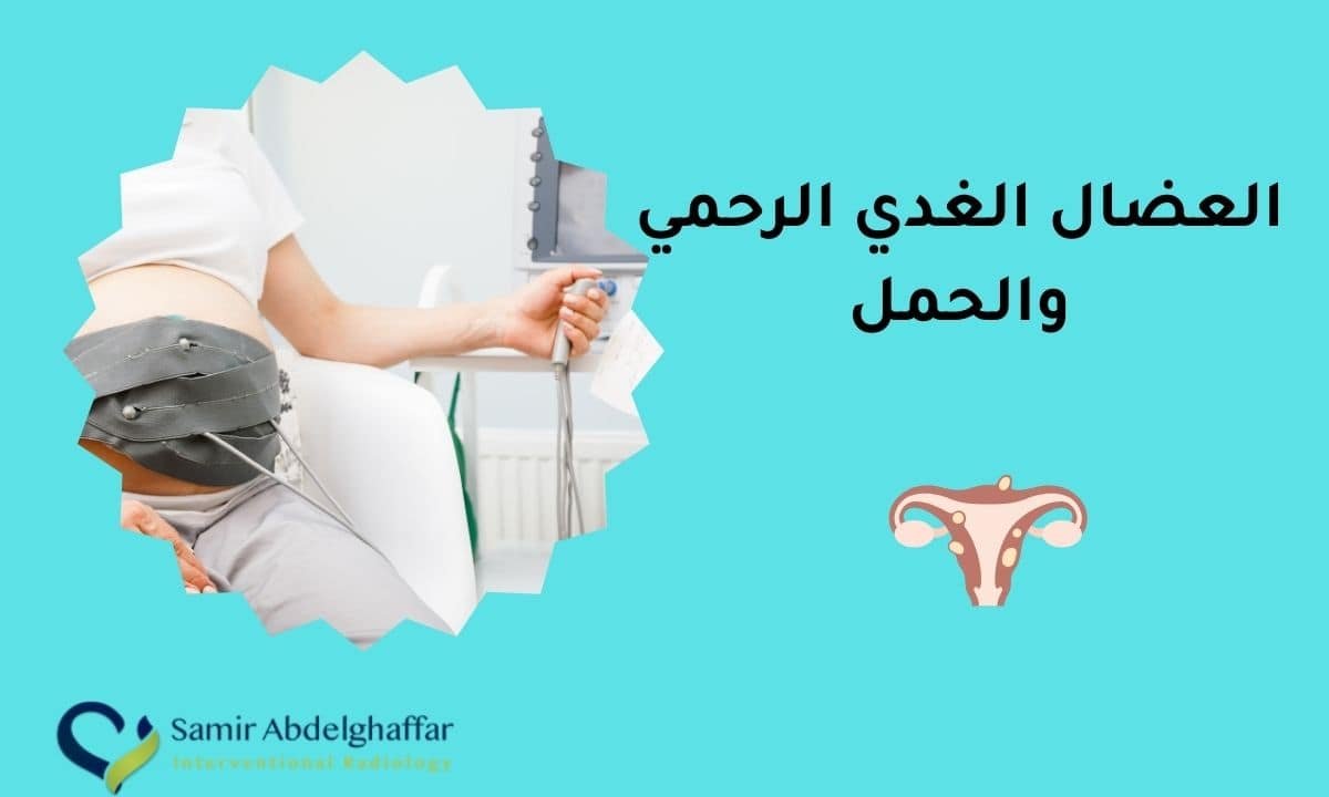 العضال الغدي الرحمي والحمل