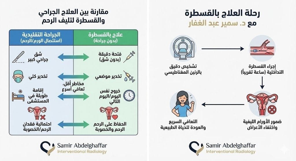 علاج تليف الرحم بالقسطرة
